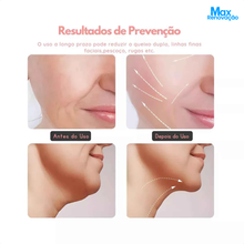 Carregar imagem no visualizador da galeria, Massagem Facial - Led Aparelho Tratamento Com Luz Bivolt