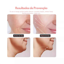 Carregar imagem no visualizador da galeria, Massagem Facial - Led Aparelho Tratamento Com Luz Bivolt
