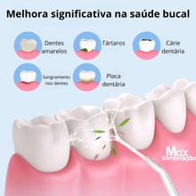Carregar imagem no visualizador da galeria, Irrigador Bucal Recarregável Portátil | - Max Renovação
